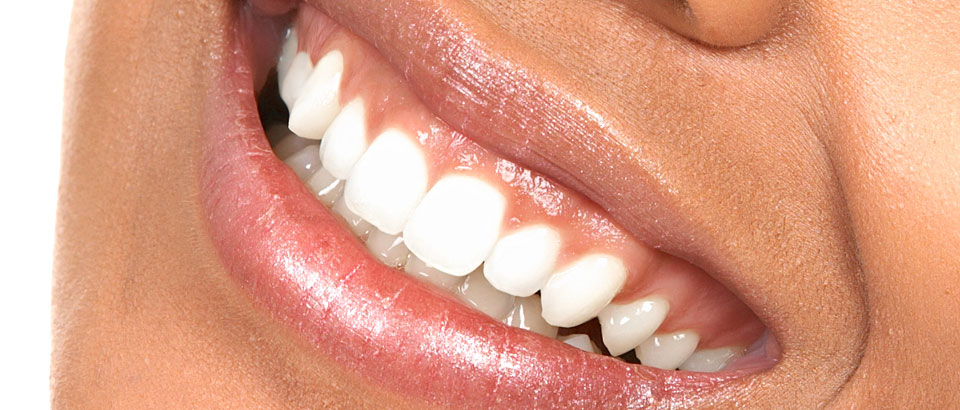 Cosmetic Dentistry in St. Pete for a Winning Smile