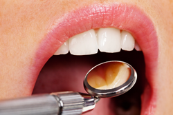 regular check ups can prevent gum disease