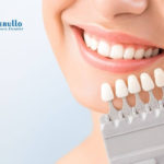 is-teeth-whitening-safe