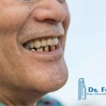 causes-of-tooth-loss
