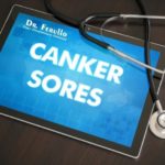 how-to-treat-canker-sores