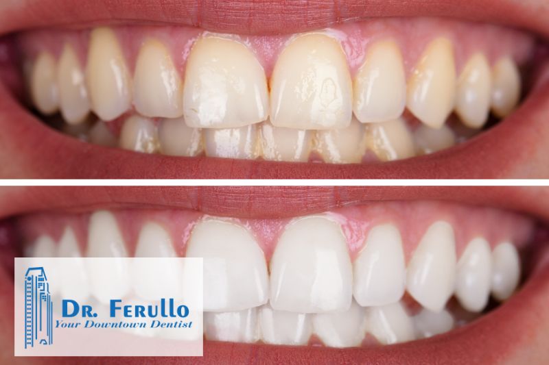 Effective tips for teeth whitening from your trusted dentist